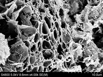 Sputum taken with the Centre for NanoHealth’s Scanning Electron Microscope (SEM)